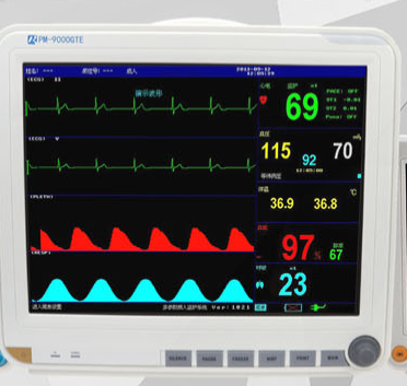 哪里有靠谱的监护仪